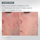 Die Nahaufnahme der Wange einer Person zeigt das Vorher-Nachher-Ergebnis: weniger dunkle Flecken und hellere Haut nach 1-4-wöchiger Anwendung von Petite Pleasures Microfoliant.