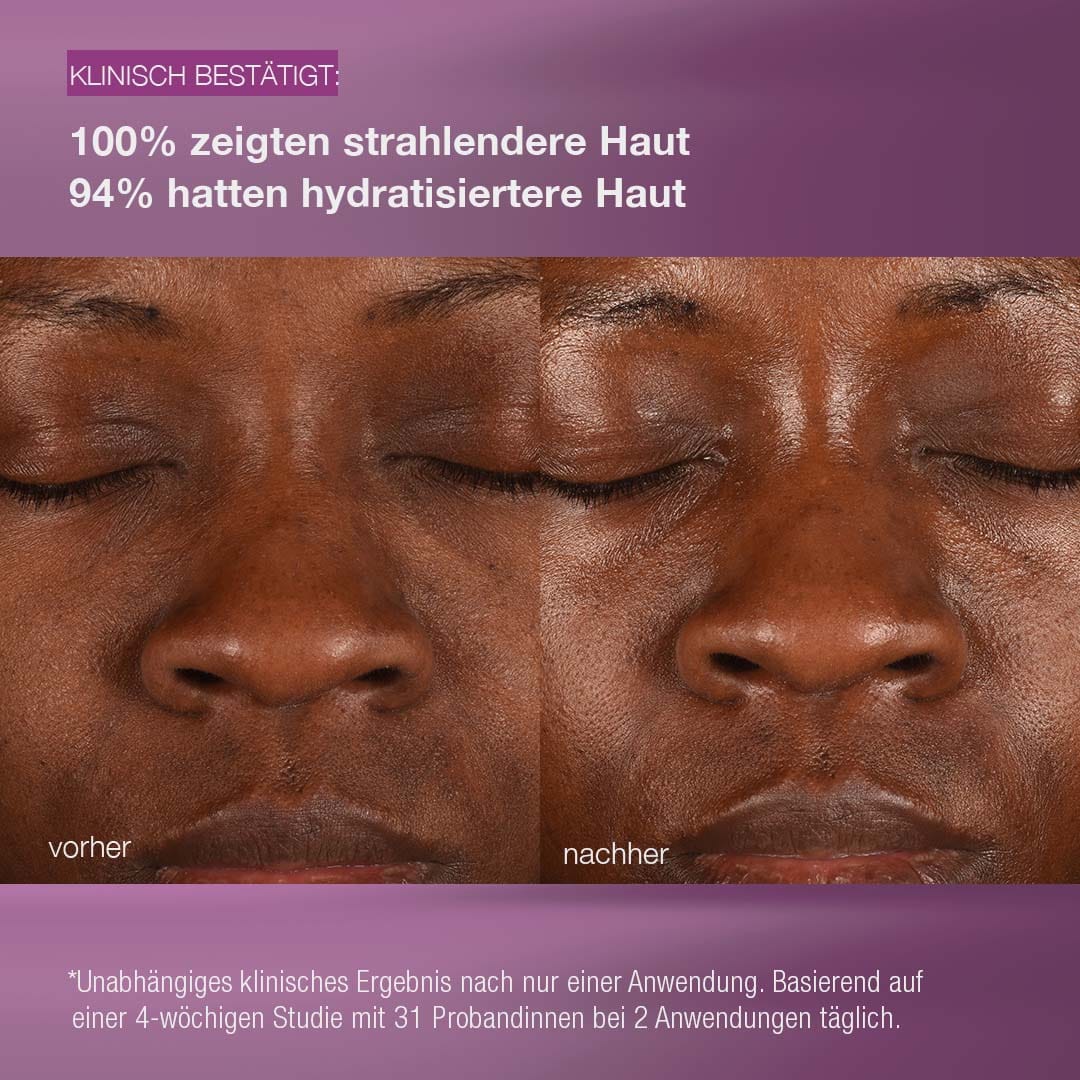 Nahaufnahme eines Gesichts, die das "Vorher" (links) und das "Nachher" (rechts) zeigt und die verbesserte Hydratation und Ausstrahlung mit der MultiVitamin Power Recovery Cream für gestresste Haut hervorhebt. Der deutsche Text beschreibt die klinischen Ergebnisse.