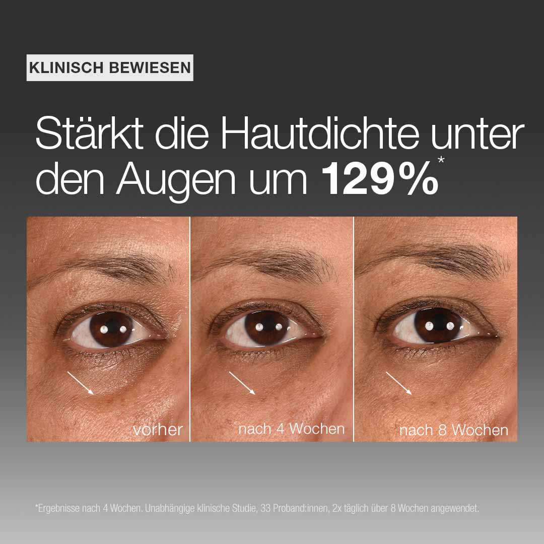 Drei Nahaufnahmen zeigen die Haut unter den Augen vor der Behandlung, nach 4 Wochen und nach 8 Wochen und veranschaulichen die gesteigerte Hautdichte im Augenbereich durch die Anwendung unseres Smart Eye Density Serums.