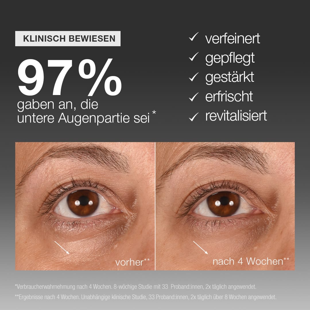 Vorher-Nachher-Fotos der Augenpartie einer Frau, die eine sichtbare Verbesserung der Hautstruktur nach vierwöchiger Anwendung des „Smart Eye Density Serums“ mit Wachstumsfaktorkomplex zeigen. Der deutsche Text hebt die Ergebnisse klinischer Studien und Vorteile wie „erhöhte Hautdichte in der Augenpartie“ hervor.